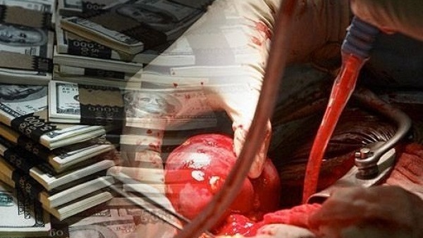 المصادر غير التقليدية