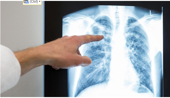 تسريب بيانات ملايين